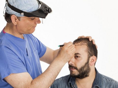 Permenent Hair Transplant in Islamabad
