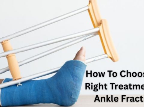 Right Treatment For Ankle Fractures