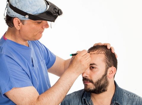 Hair Transplant in Islamabad