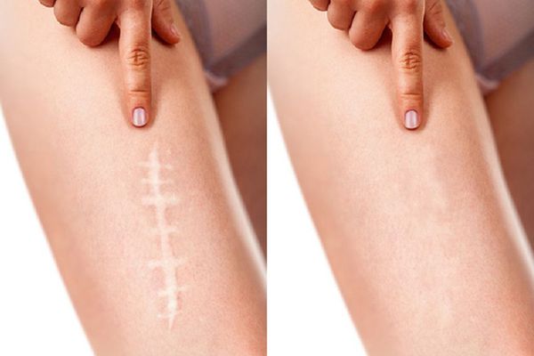 Call Girls In Karol Bagh 81789~66642 Escort SerivCe Booking Call and Out Call